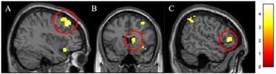 Culture Impacts the Neural Response to Perceiving Outgroups Among Black and White Faces